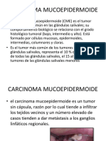 Carcinomamucoepidermoide 130506190628 Phpapp02