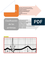 Ondas Cardiacas