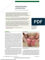 Disseminated Lyme Disease Presenting With Nonsexual Acute Genital Ulcers