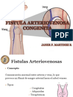 Fistulaarteriovenosacongenita 121123051711 Phpapp02