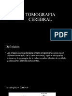 Tomografia Cerebral