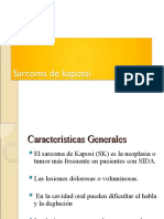 Sarcoma de Kaposi