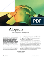Alopecia.