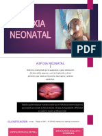 Asfixia Neonatal y RCP