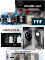 Radiologia de Torax