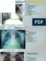 Practica Radiografia de Torax_ - Fernanda Burgos Balderrama