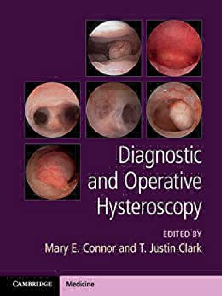 MCU 2020 Diagnostic and Operative Hysteros | PDF | Gynaecology | Women's  Health