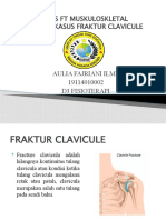 FT Muskuloskletal PLF Clavicule - Aullia