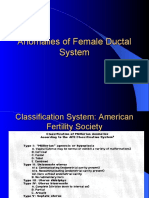 Anomalies of Female Ductal System