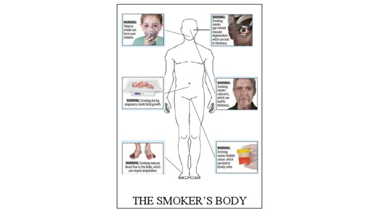 The Smoker's Body | PDF