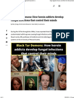 Black Tar Demons - How Heroin Addicts Develop Fungal Infections That Control Their Minds - Gnostic Warrior by Moe Bedard
