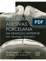 Restaurações Adesivas de Porcelana Na Dentição Anterior