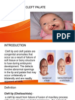 434821808-Cleft-Lip-and-Cleft-Palate