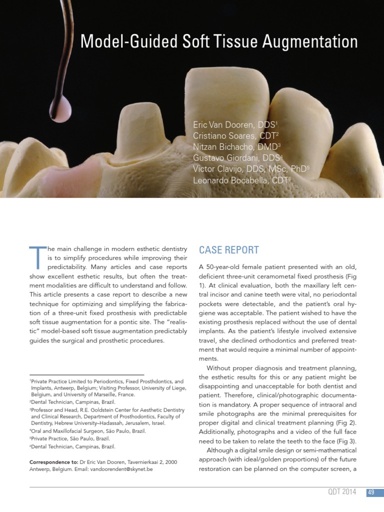 Model Guided Soft Tissue Augmentation | PDF | Dental Implant ...