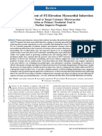 Optimized Treatment of ST-Elevation Myocardial Infarction: Review