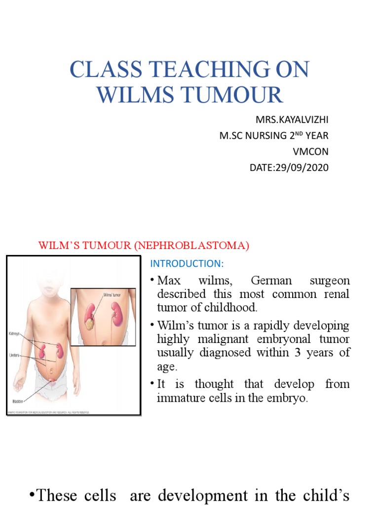 Nursing Management of Wilms Tumor | PDF | Chemotherapy | Neoplasms