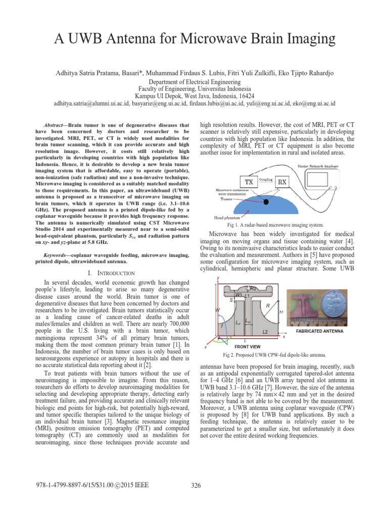 A UWB Antenna For Microwave Brain Imaging | PDF | Medical Imaging ...