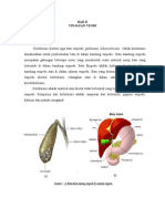 LP Cholelitiasis