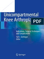 Unicompartmental Knee Arthroplasty