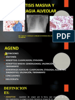 Hemoptisis Masiva Y Hemorragia Alveolar: Dr. Carlos I. Gonzalez Andrade R3 Neumología Centro Medico Nacional de Occidente