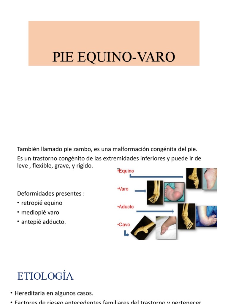 Pie EquinoVaro PDF Pie Diagnostico medico