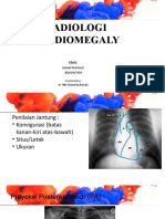 Ilham Cardiomegaly