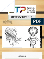 Exposición Hidrocefalia - Ronda Neurocirugía