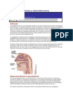 Amigdalectomía y Adenoidectomía