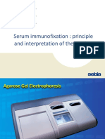 Serum Immunofixation: Principle and Interpretation of The Results