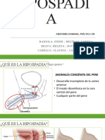 Hipospadia Final