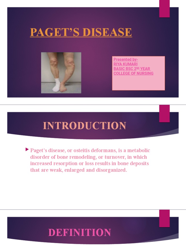 Paget'S Disease Presented ByRiya Kumari Basic BSC 2 Year College of