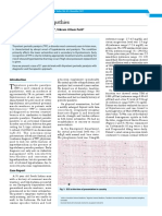 Thyrotoxic Channelopathies