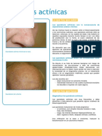 09-Queratosis Actínicas