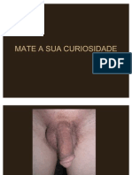 Cirurgia de Mudança de Sexo