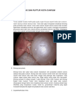 Torsio Dan Ruptur Kista Ovarium - Arya Brilian & Gusti Faisal Anshori