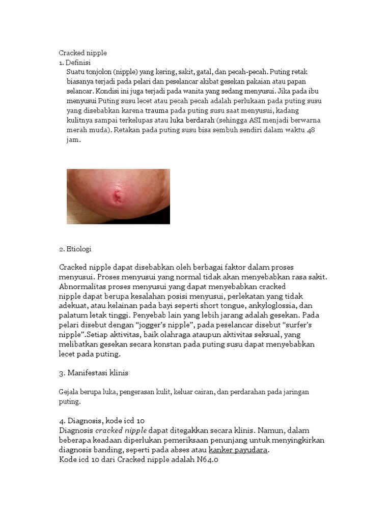 diagnosis-dan-penanganan-puting-lecet-pdf-kesehatan-holistik