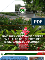 Caso Clinico Fractura