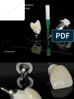 Amprenta implantologie