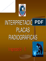 Interpretación de Placas Radiográficas