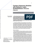 Cavitary Pulmonary Nodules With Systemic Lupus Erythematosus