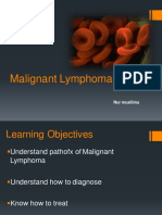 Malignant Lymphoma: Nur Muallima