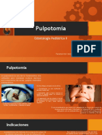 Pulpotomía