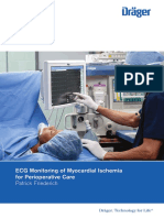 Ecg Monitoring of Myocardial Ischemia Br 9066445 En