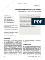 An Enormous Compensatory Hyperinflated Lung After Pneumonectomy: Pseudo-Horseshoe Lung