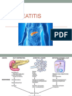 Acute Pancreatitis