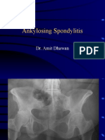 Ankylosing Spondylitis: Dr. Amit Dhawan
