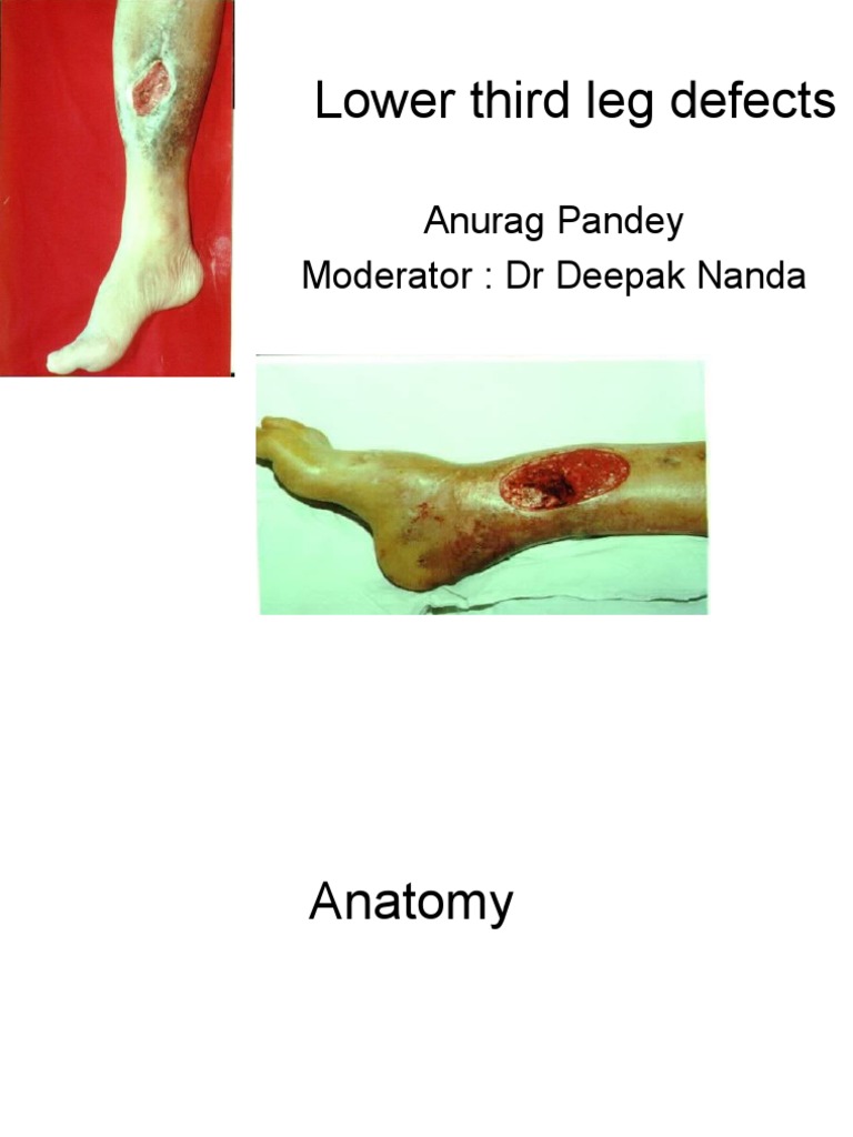 Anatomy and Reconstruction Techniques for Lower Third Leg Defects PDF