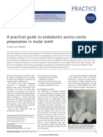 A Practical Guide To Endodontic Access Cavity Preparation in Molar Teeth