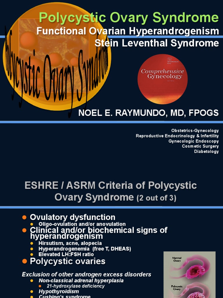 Gyne Pcos | PDF | Polycystic Ovary Syndrome | Luteinizing Hormone