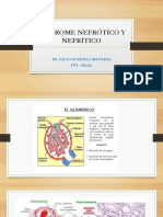 Sindrome Nefrótico y Nefrítico